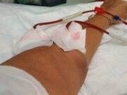 Ipercolesterolemia familiare: una patologia a molti sconosciuta ipercolesterolimia-familiare-aferesi-dld-trattamento